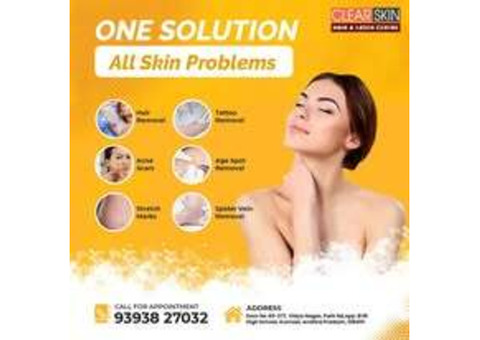 Best Acne Scar Laser Treatment  In India