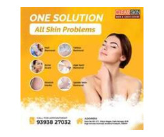 Best Acne Scar Laser Treatment  In India