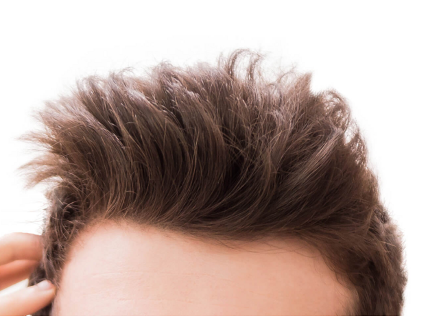 Regain Your Style with the Best Hair System in Lake Forest