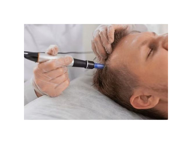 Stem Cell Therapy For Hair Loss