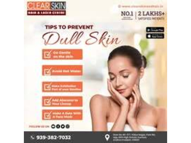 Birthmark removal treatment in india