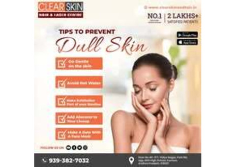 Birthmark removal treatment in india