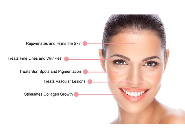 Acne Treatment in Upper Mount Gravatt