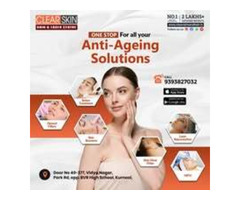 best vbeam laser treatment in india