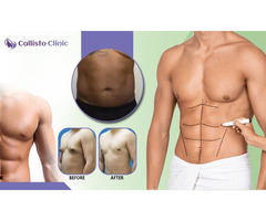 Safe & Effective Liposuction in Surat – Callisto Clinic