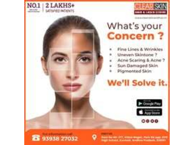 PRP hair Treatment in india