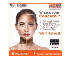 PRP hair Treatment in india