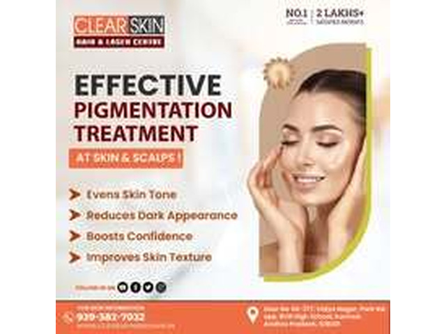 Best Advanced Xanthelasma Treatment in india