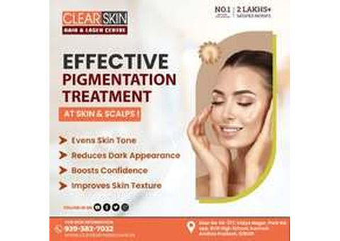 Best Advanced Xanthelasma Treatment in india
