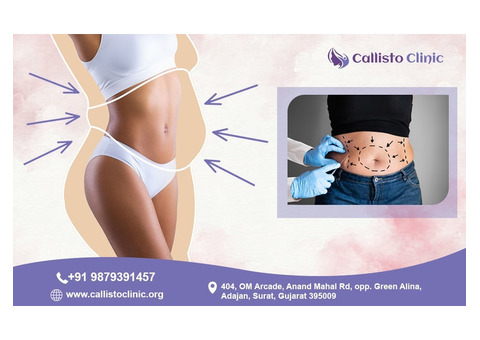 Advanced Liposuction in Surat | Callisto Clinic Specialists