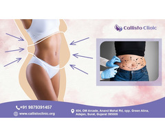 Advanced Liposuction in Surat | Callisto Clinic Specialists