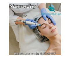 The best microneedling chicago