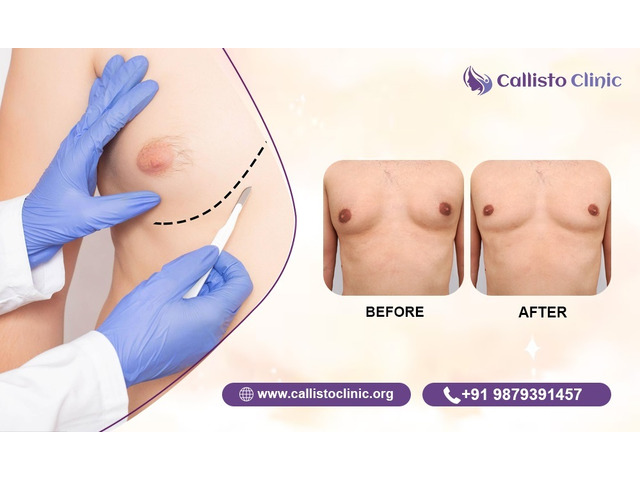Callisto Clinic Trusted Male Breast Reduction Expert