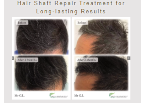 Say Goodbye to Damaged Hair with Aushair’s Hair Shaft Repair Treatment