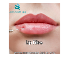 Lip Fillers Chicago Injections