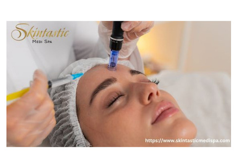 Advanced Potenza Microneedling Near Me for Youthful Skin