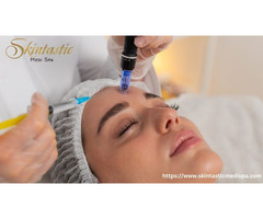 Advanced Potenza Microneedling Near Me for Youthful Skin