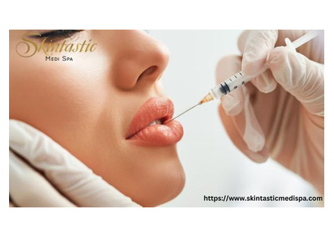 Achieve Perfect Shaped Lips with Lip Fillers Riverside