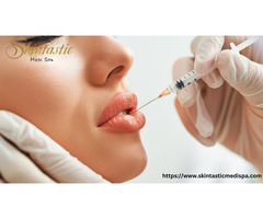 Achieve Perfect Shaped Lips with Lip Fillers Riverside