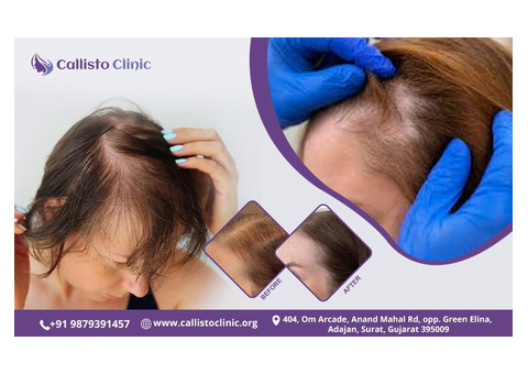 Best Hair Restoration in Surat – CallistoClinic