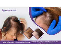 Best Hair Restoration in Surat – CallistoClinic
