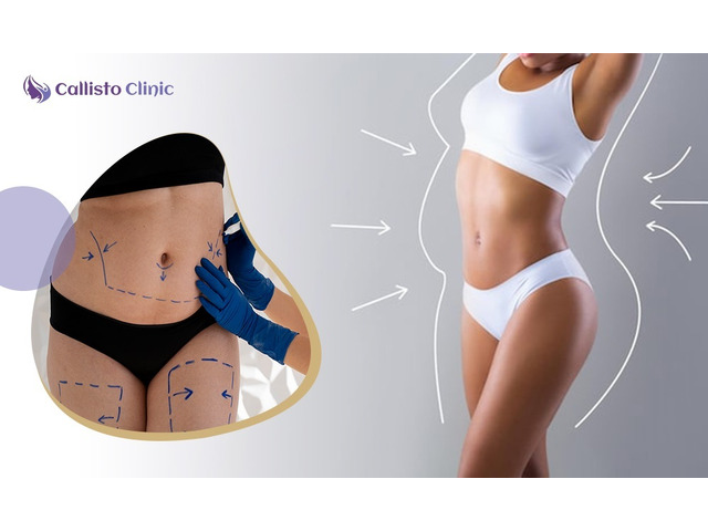 Trusted Liposuction Experts in Surat – Callisto Clinic