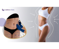 Trusted Liposuction Experts in Surat – Callisto Clinic