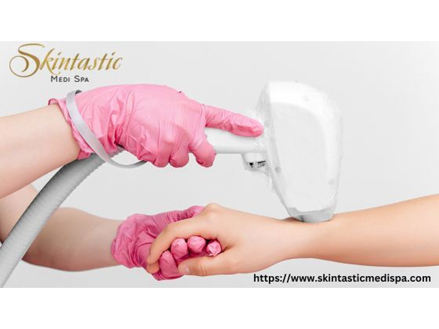 Best Laser Hair Removal in Riverside for Hair-Free Skin