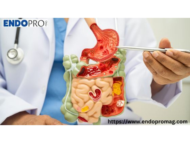 Understanding Digestive Disorders Symptoms and Pain