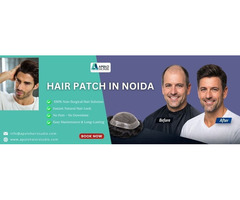 Best Hair Patch in Noida, Hair Patch Solutions - Apolo Hair Studio
