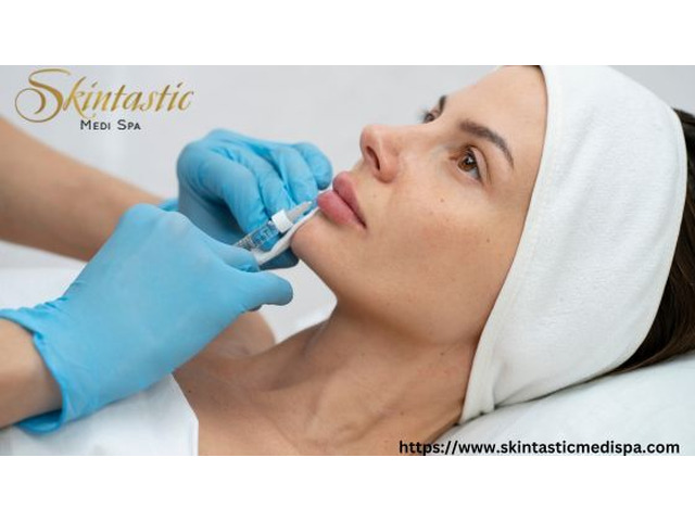 Safe and Advanced Fillers Riverside for Facial Contouring