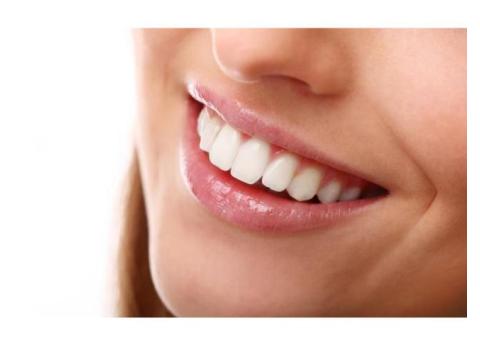 Get Your Teeth Become White | Springvale Dental Clinic