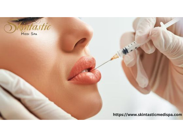 Premium Lip Fillers Riverside with Stunning Results