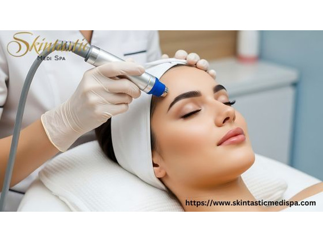 Affordable Hydrafacial in Riverside for Instant Glow