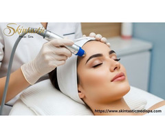 Affordable Hydrafacial in Riverside for Instant Glow