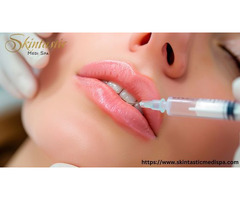 Lip Fillers Riverside for Beautiful Volume Boost