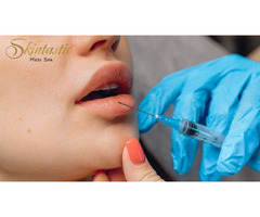 Affordable Lip Fillers Riverside for Perfect Volume