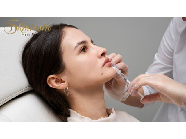 Affordable Fillers Riverside for Smooth and Youthful Skin