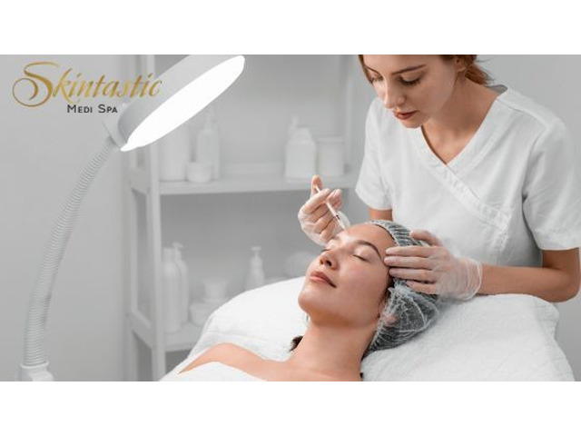 Natural Looking Dermal Fillers Riverside for Smooth Skin