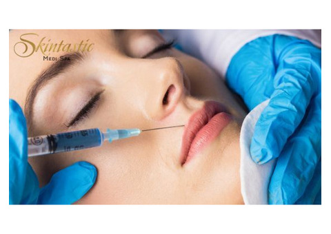 Best Lip Fillers Riverside for Smooth and Plump Lips