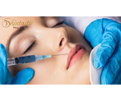 Best Lip Fillers Riverside for Smooth and Plump Lips