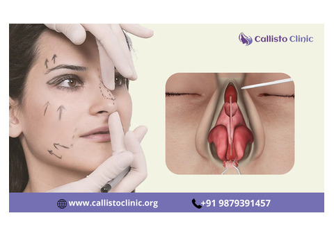 Precision Rhinoplasty Treatment Available in Surat - Callisto Clinic