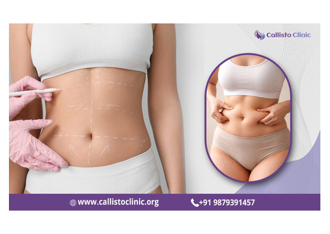 Liposuction Services by Dr. Rushin Thakor- Callisto Clinic