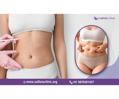 Liposuction Services by Dr. Rushin Thakor- Callisto Clinic