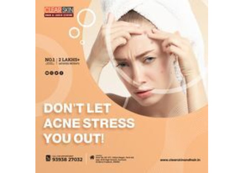 port wine stain Treatment in Kurnool