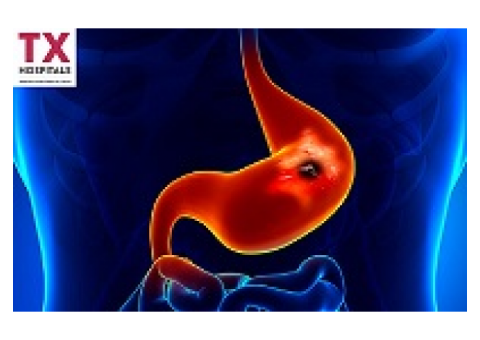 Best Gastroentorology Treatment in Kachiguda, Uppal