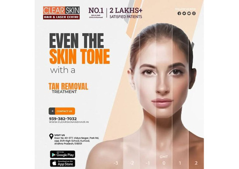 Laser treatment clinic in india