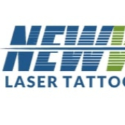 New Wave Laser Tattoo Removal